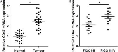 CD47 Enhances Cell Viability and Migration Ability but Inhibits Apoptosis in Endometrial Carcinoma Cells via the PI3K/Akt/mTOR Signaling Pathway